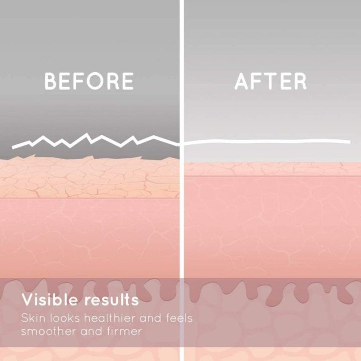 Vakuuminis veido mikrodermabrazijos prietaisas su safyru dengtu antgaliu HoMedics Radiance, rožinio aukso ir baltos spalvos